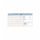  Edan SE 1010 SOFTWARE SE-1515